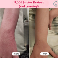 Baby Eczema Beef Tallow Balm